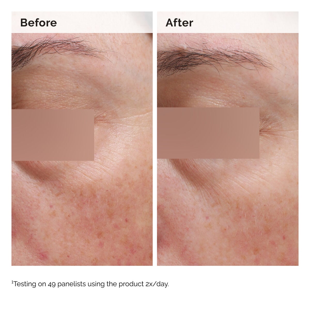 niacinamide-5-face-and-body-emulsion-x2 2024-08-23-ORD-Nia-5pct-Face-Body-B-A-Elasticity-Global-02-1x1.jpg