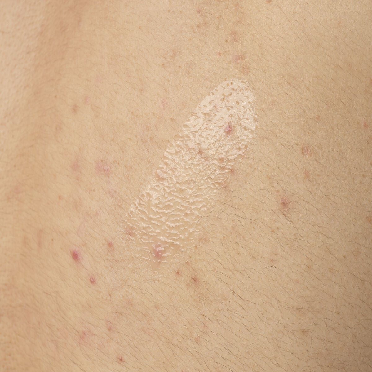 salicylic-acid-0-5-body-serum-j8 ORD-salicylic-acid-05-body-240ml-application.jpg