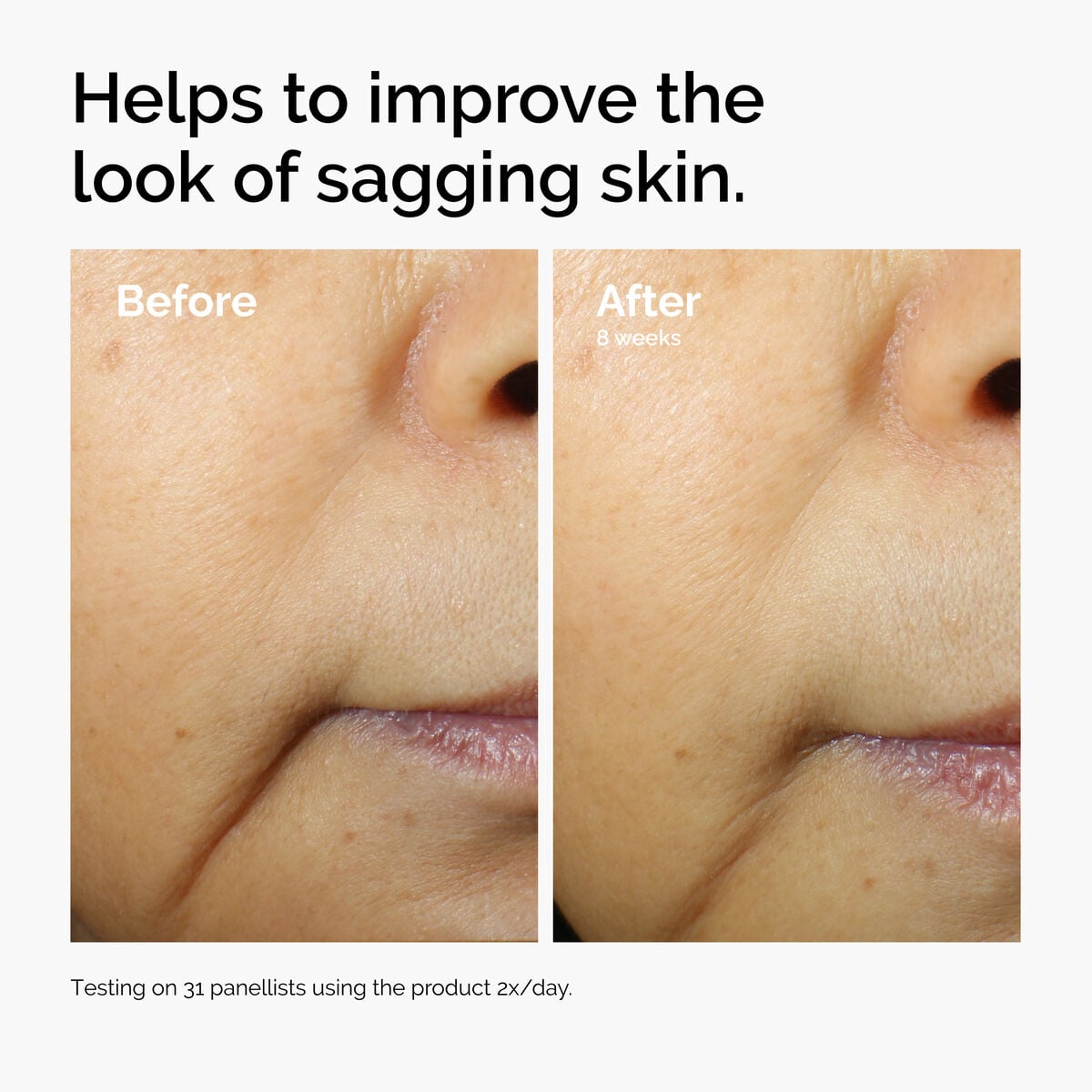 caffeine-3-escin-1-face-serum-a2 ord-caffeine-3pct-escin-1pct-face-serum-before-after-sagging.jpg