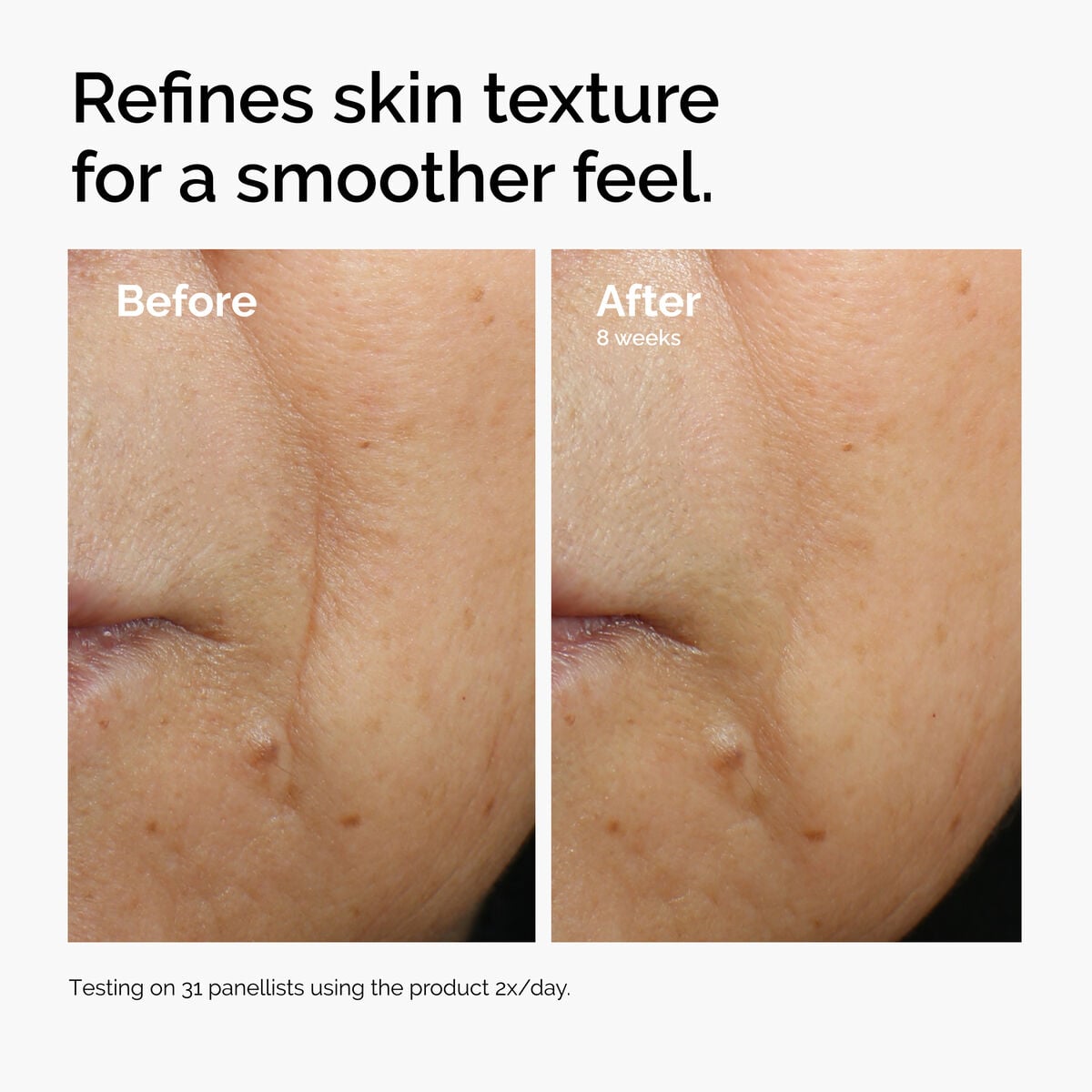 caffeine-3-escin-1-face-serum-a2 ord-caffeine-3pct-escin-1pct-face-serum-before-after-texture.jpg