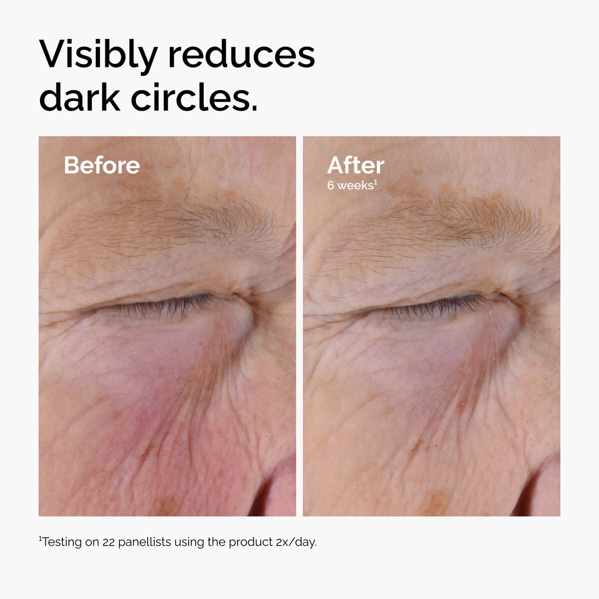 caffeine-solution-5-egcg-eye-serum-v1 ord-caffeine-solution-egcg-dark-circles-before-after.jpg