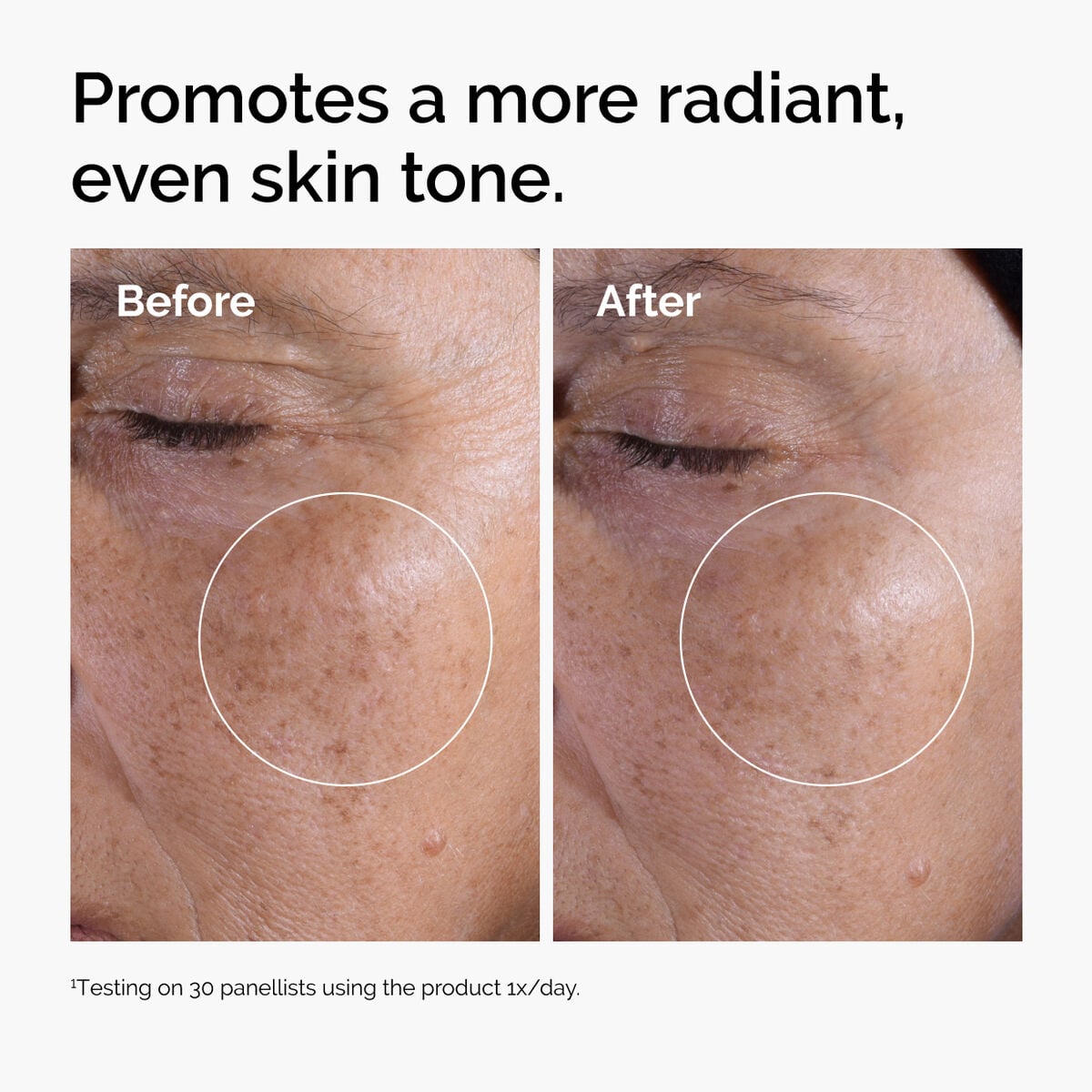glycolic-acid-7-exfoliating-toner-h9 ord-glycolic-before-after-radiance.jpg