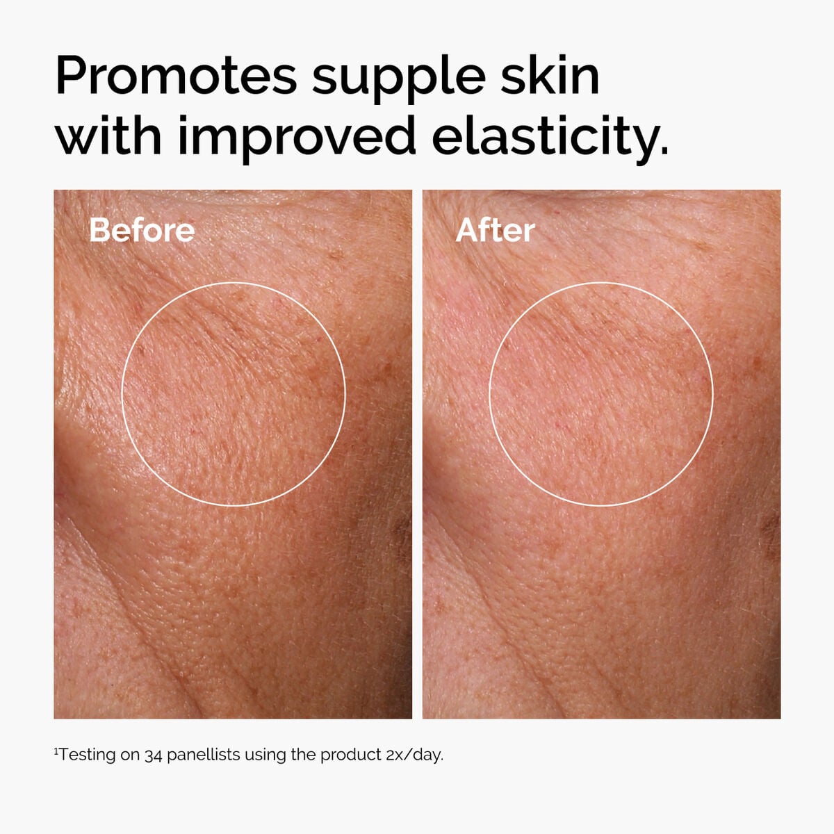 hyaluronic-acid-2-b5-with-ceramides-z0 ord-hyaluronic-acid-2pct-b5-hydrating-serum-before-after-elasticity.jpg