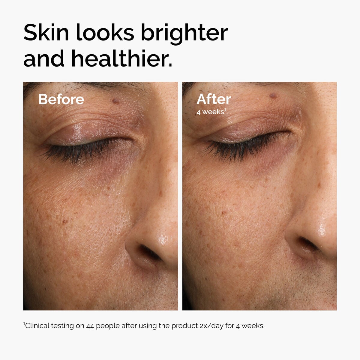 multi-antioxidant-radiance-serum-q0 ord-mars-before-after-healthy.jpg