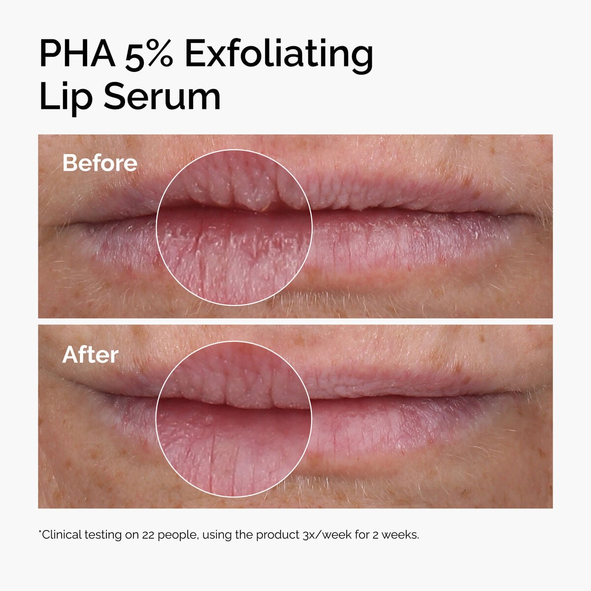 pha-5-exfoliating-lip-serum-f9 ord-pha-5pct-lip-exfoliating-serum-before-after.jpg