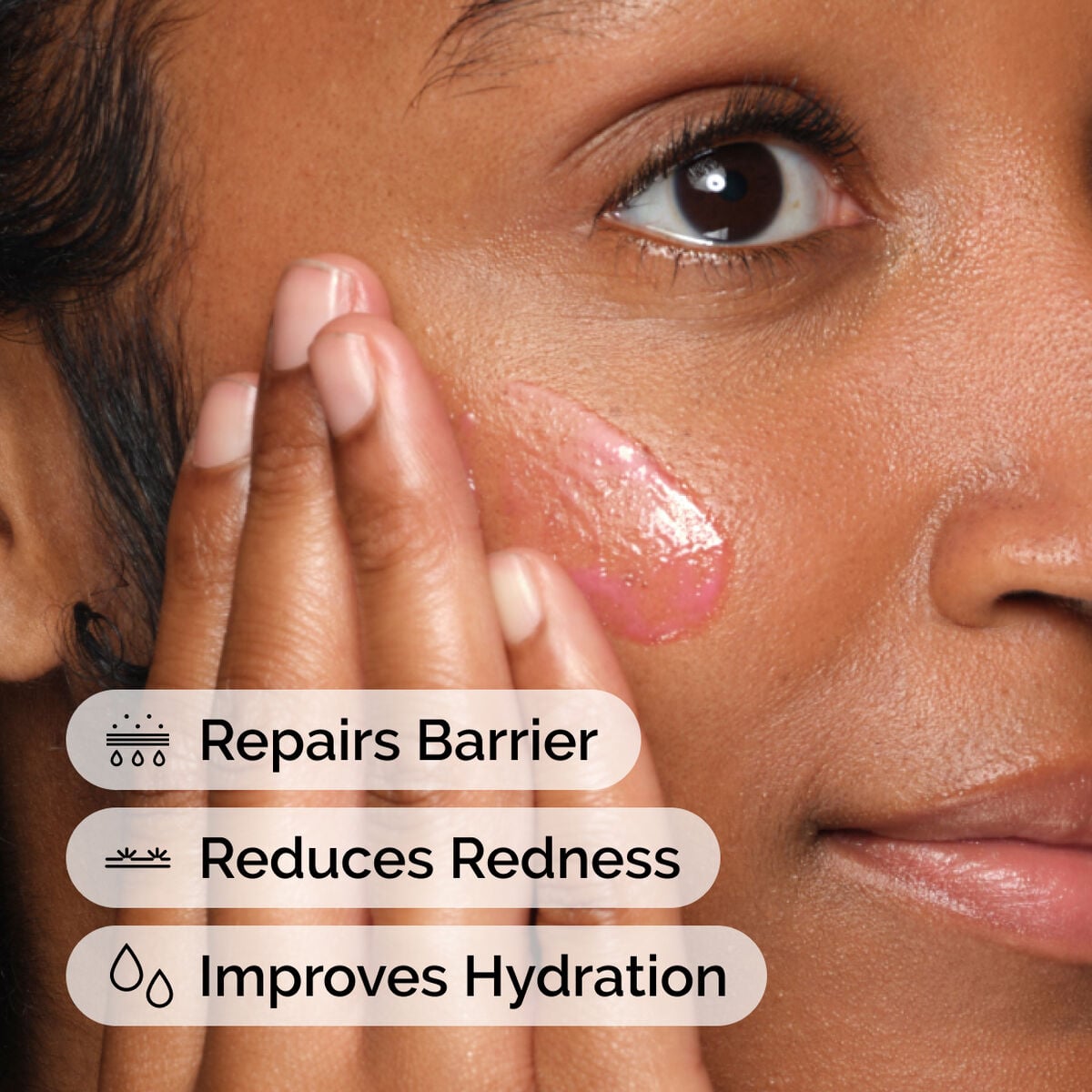 soothing-and-barrier-support-serum-set-u3 ord-soothing-barrier-support-serum-model-application-with-benefits.jpg